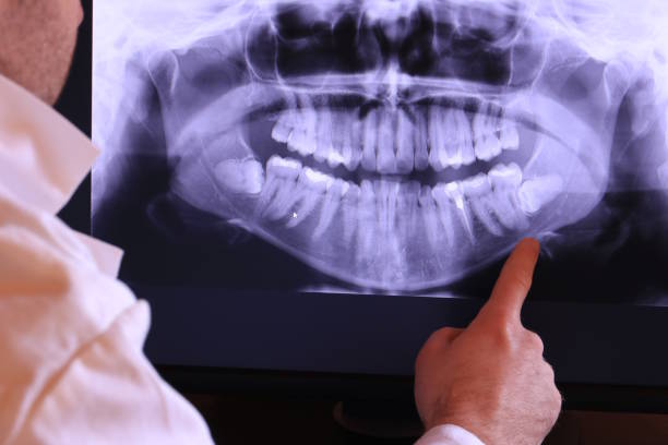Best Weekend Emergency Dentist in Lawrence, IN