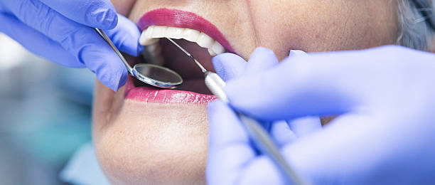 Best Emergency Dental Care for Broken or Chipped Teeth in Lawrence, IN